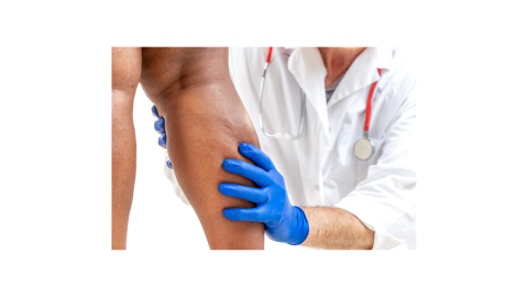 The CEAP Classification: What You Should Know