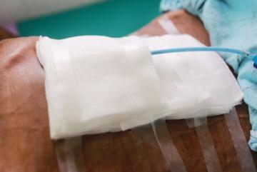 surgical wound bandage and drainage